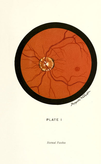 The Ophthalmoscope and How to Use it [12 Images]