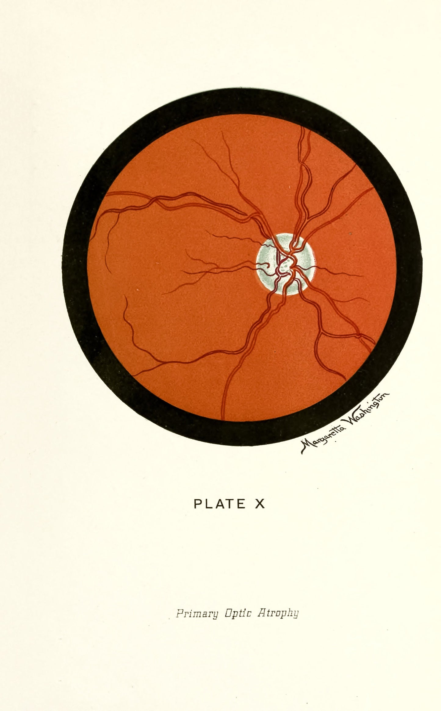 The Ophthalmoscope and How to Use it [12 Images]