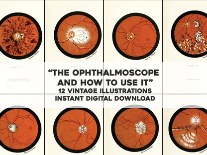 The Ophthalmoscope and How to Use it [12 Images]