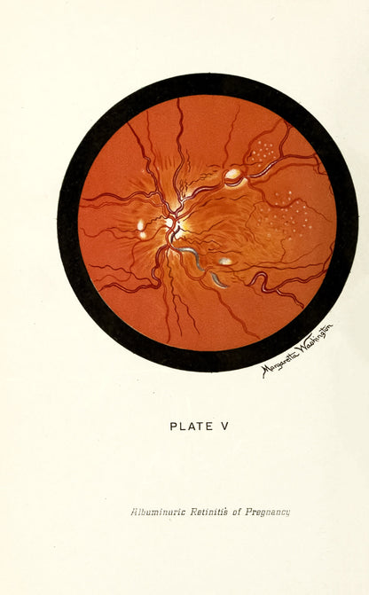 The Ophthalmoscope and How to Use it [12 Images]