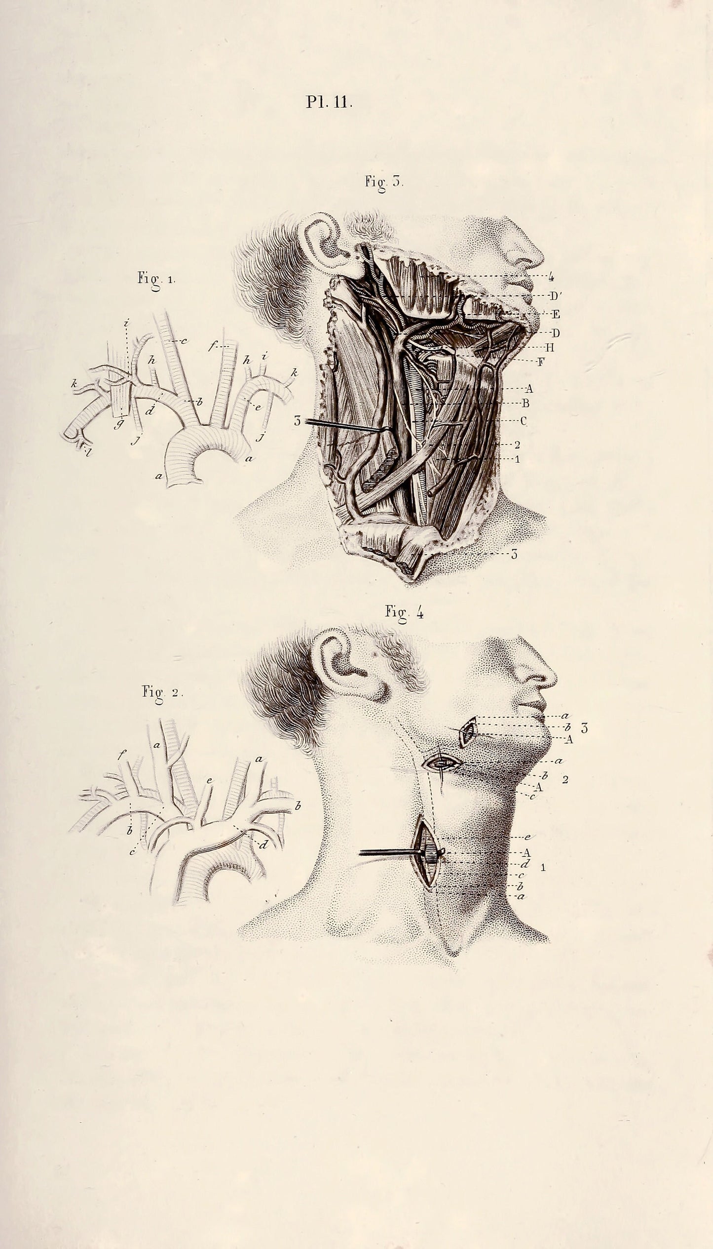 Illustrated Manual of Operative Surgery and Surgical Anatomy Set 1 [55 Images]