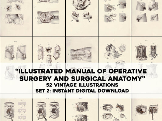 Illustrated Manual of Operative Surgery and Surgical Anatomy Set 2 [52 Images]