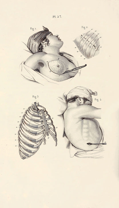 Illustrated Manual of Operative Surgery and Surgical Anatomy Set 2 [52 Images]