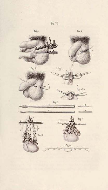 Illustrated Manual of Operative Surgery and Surgical Anatomy Set 2 [52 Images]