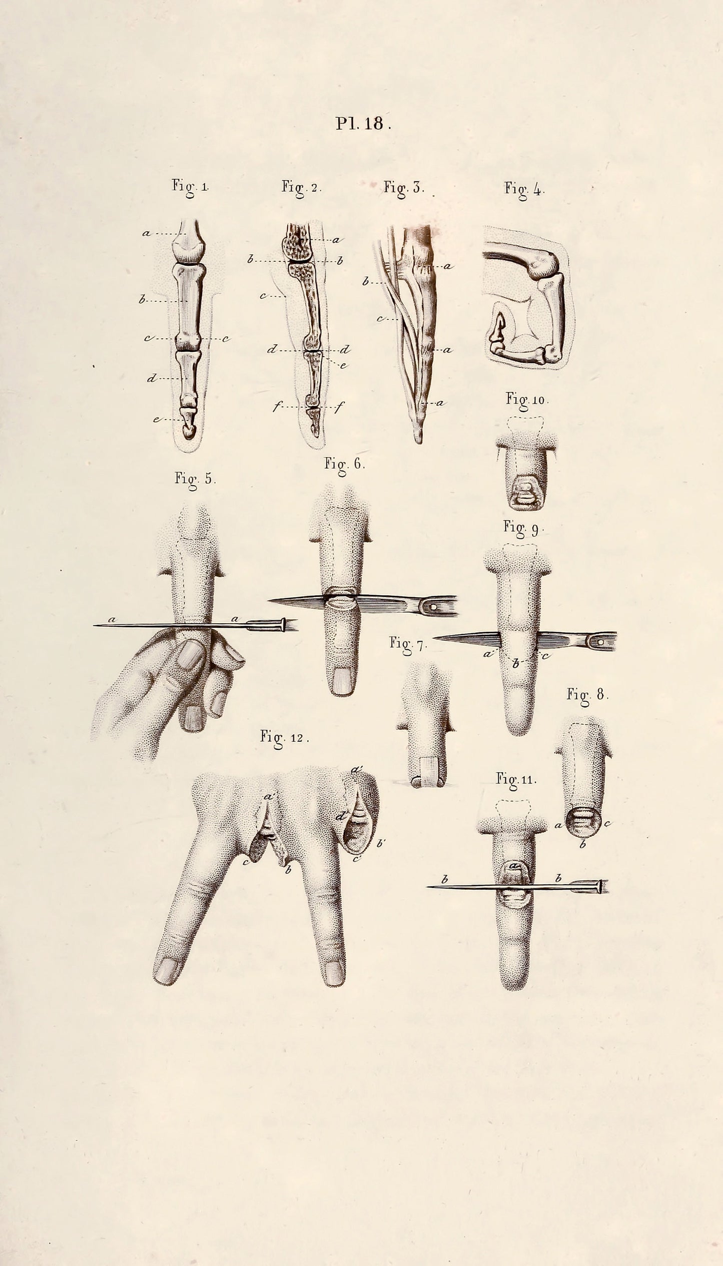 Illustrated Manual of Operative Surgery and Surgical Anatomy Set 1 [55 Images]