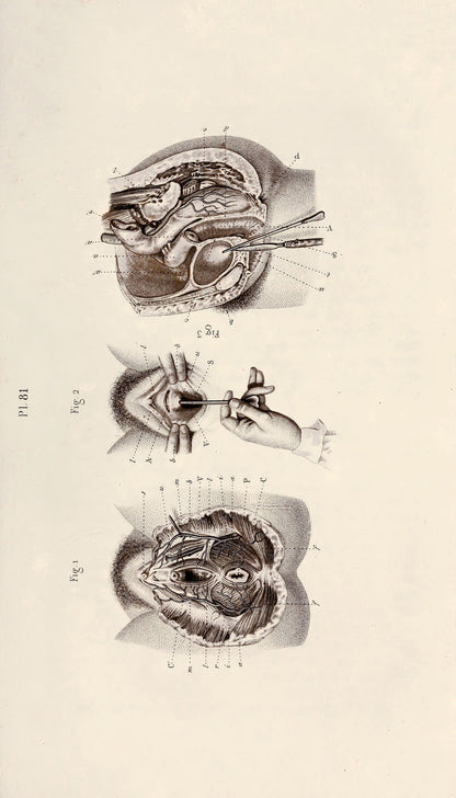 Illustrated Manual of Operative Surgery and Surgical Anatomy Set 2 [52 Images]