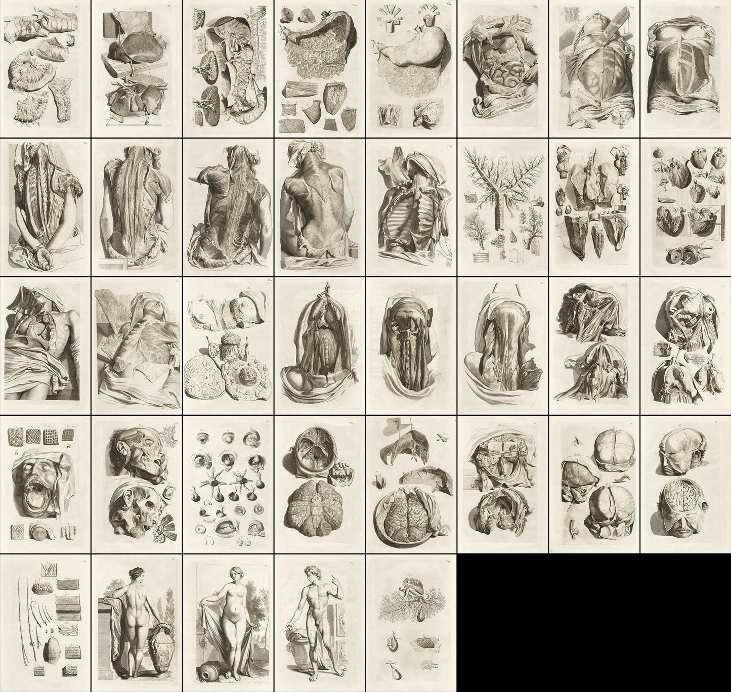 The Anatomy of Human Bodies Drawn After Life Set 1 [37 Images]