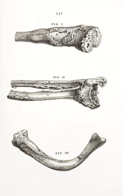 Osteographia or The Anatomy of the Bones Whitened Set 2 [61 Images]